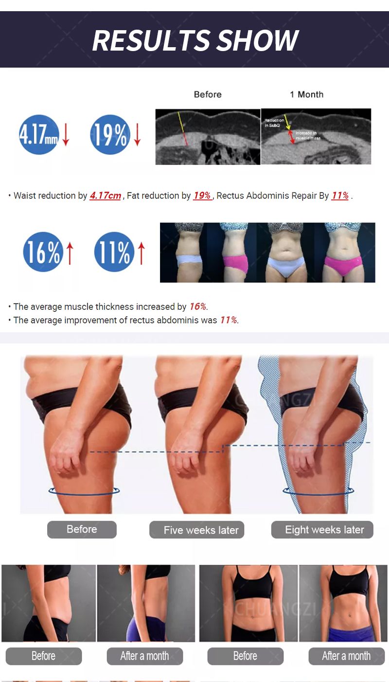 Myoslim EMS Body Sculpt RF Slimming Machine For Muscle Building