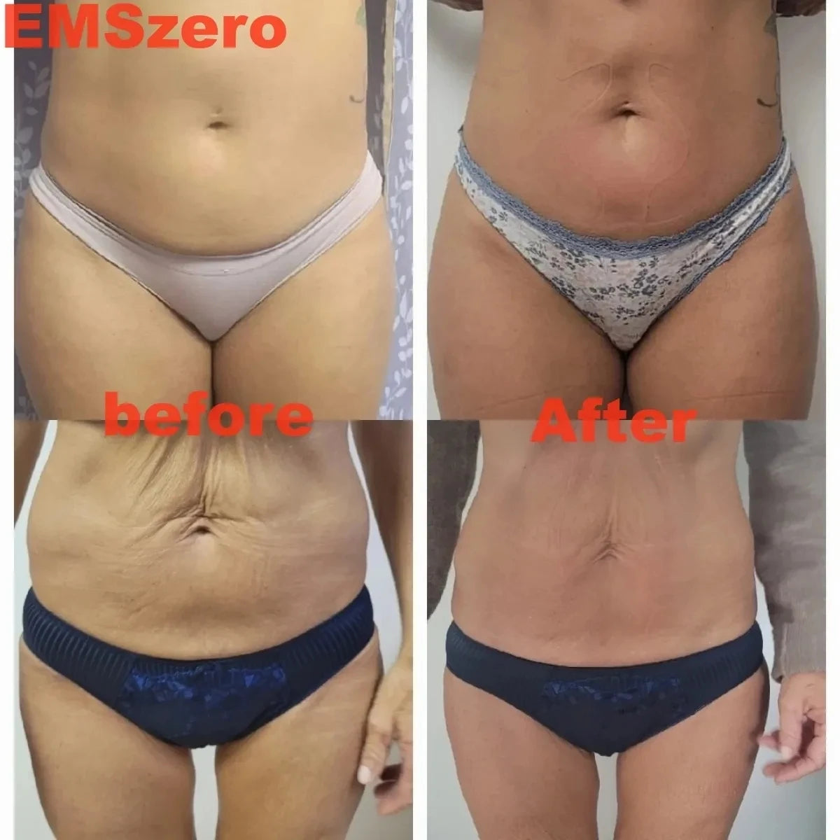 Myoslim EMS RF 6500W Body Slimming Sculpting Machine