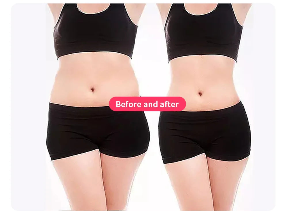 MyoSlim RF Body Shaping Machine Fat Burning And Muscle Stimulation