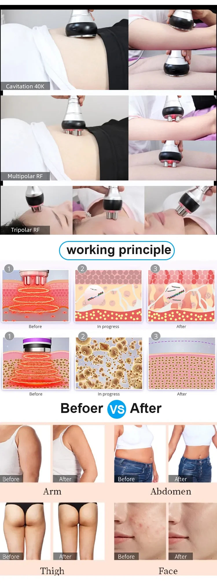 Moonic Beauty TM502 3 In 1 40K Ultrasonic Cavitation Machine
