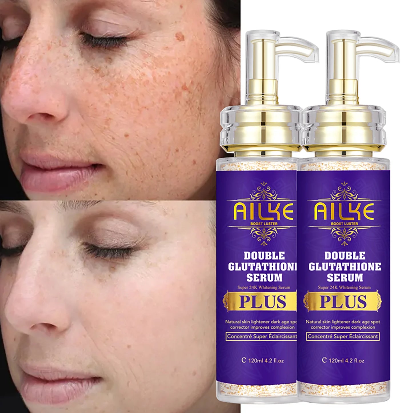 AILKE Anti Black Spots Intensive Serum Brightening for Radiant Complexion