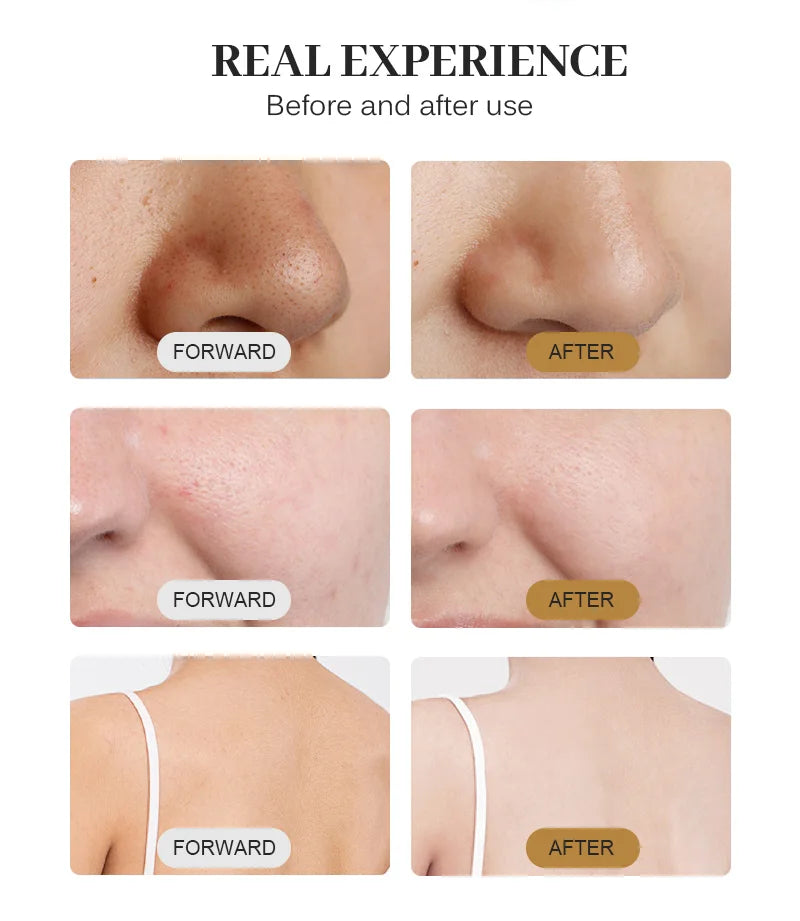 Myoslim Oxygenation Facial Hydradermabrasion Machine For Skin Care