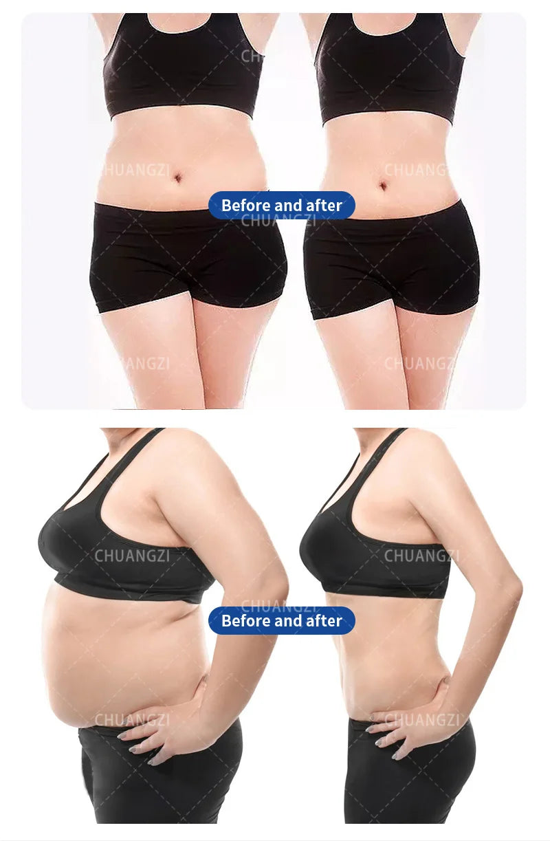 Myoslim EMS Body Sculpting And Slimming Machine With RF Shaping