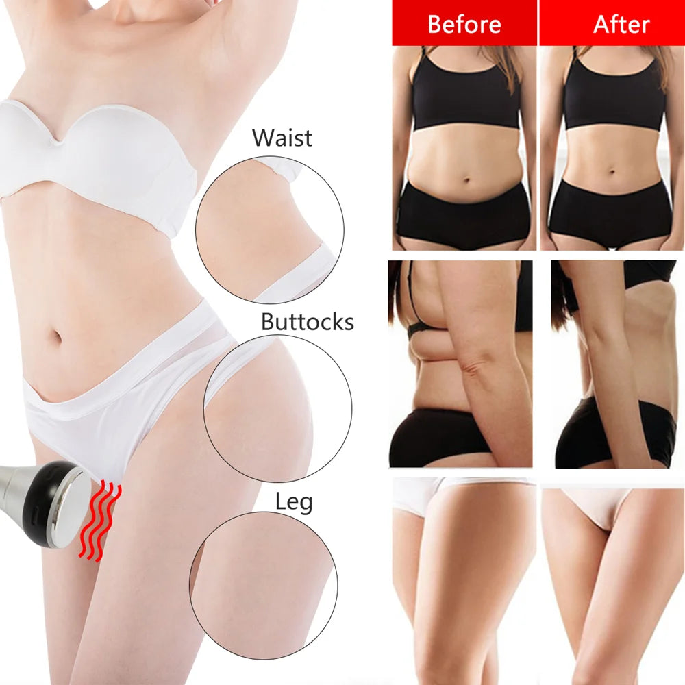Moonic Beauty TM502 3 In 1 40K Ultrasonic Cavitation Machine