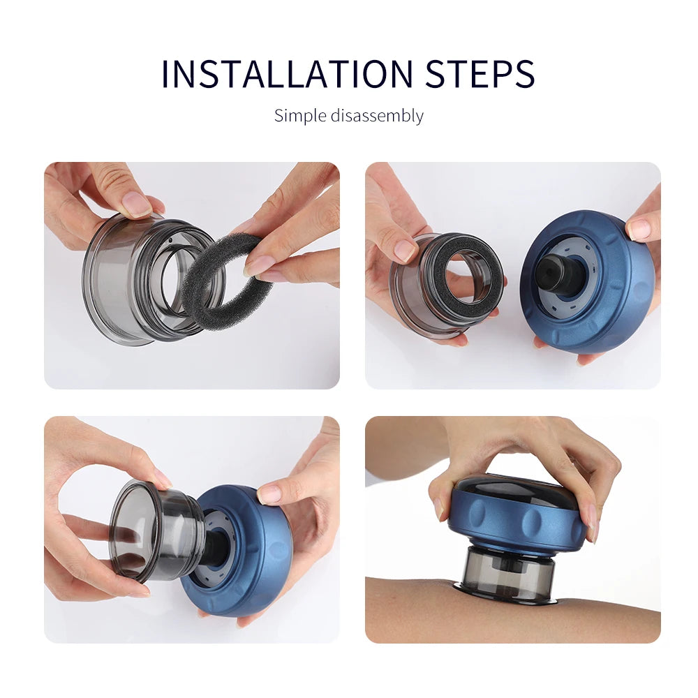 Agdoad Smart Cupping Therapy Device With 12 Levels Temperature