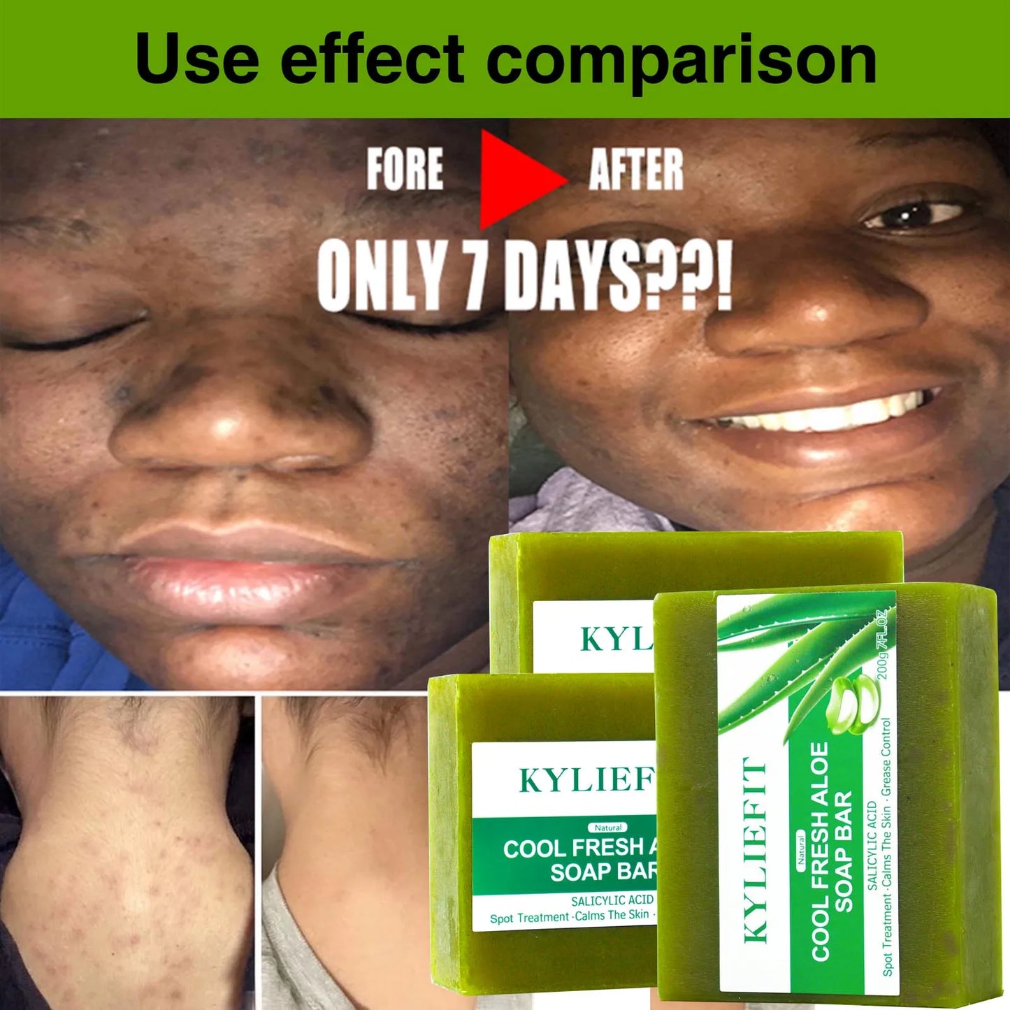 AILKE Aloe Vera Whitening Soap for Acne and Radiant Skin