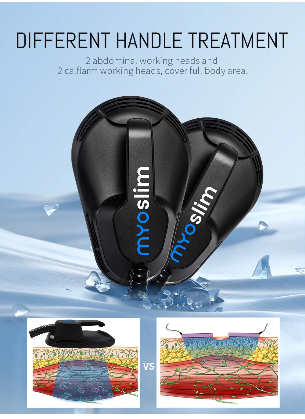 Myoslim EMS Pro Body Contouring Device for Fat Reduction