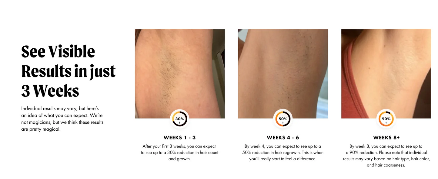 JOOYEE IPL Hair Removal Device With Auto Flash 9 Gear