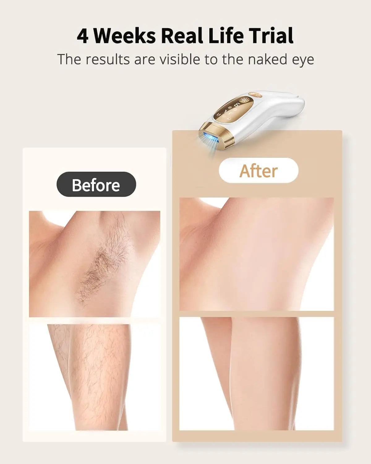 JOOYEE IPL Hair Removal Device With Auto Flash 9 Gear