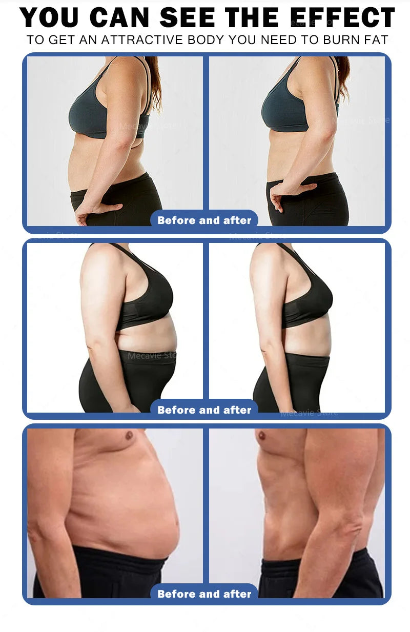 Emsnova 2 In 1 Muscle Builder Slimming Trainer For Contouring