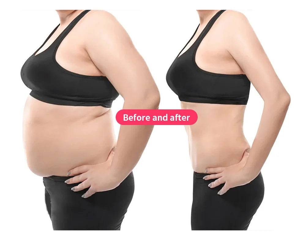 MyoSlim RF Body Shaping Machine Fat Burning And Muscle Stimulation