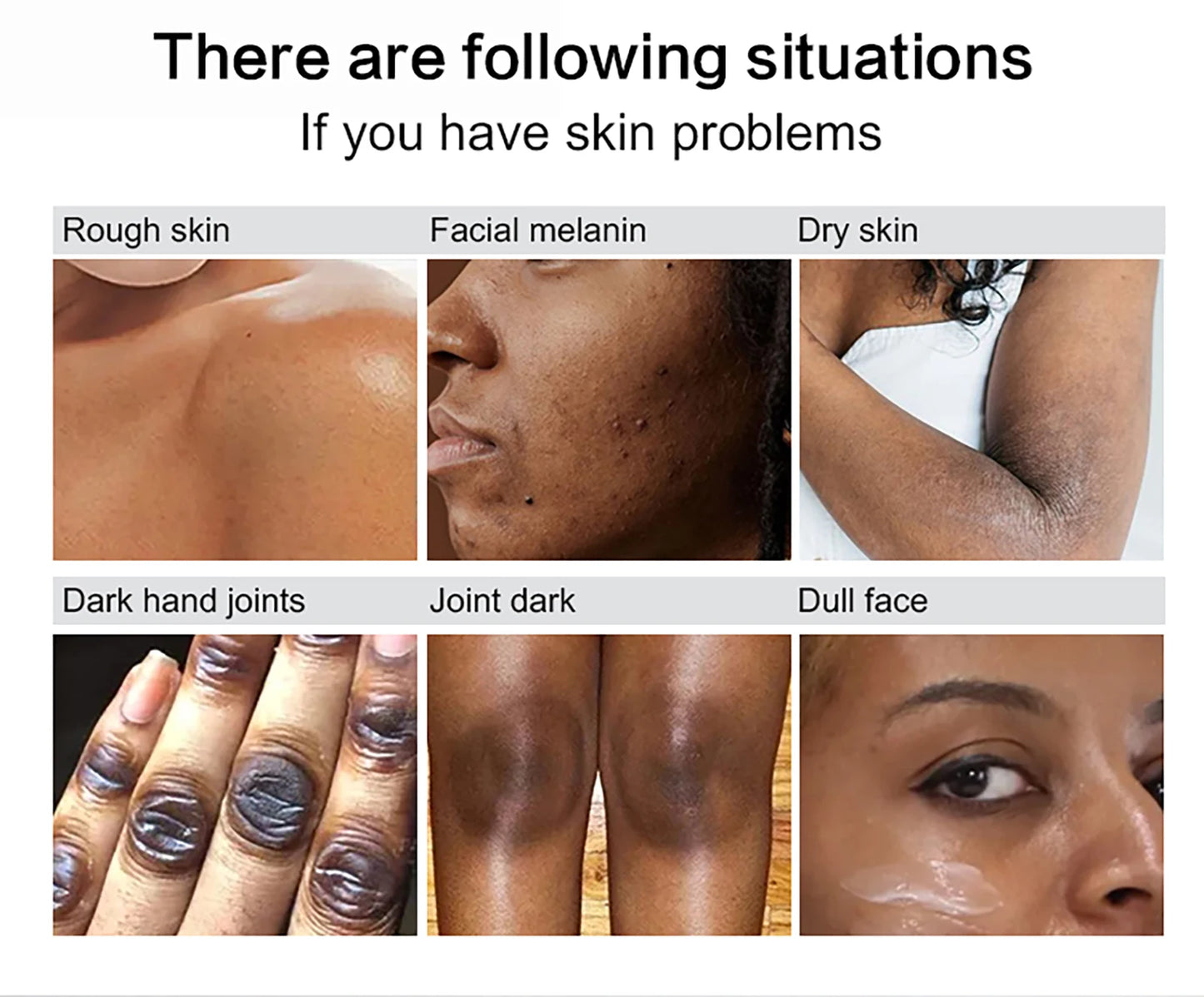 AILKE Anti Black Spots Intensive Serum Brightening for Radiant Complexion