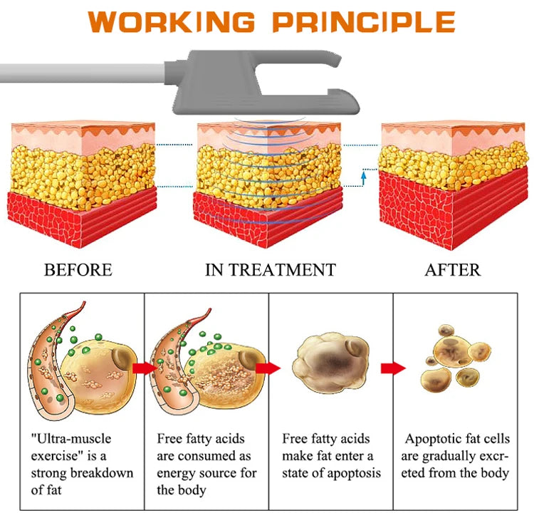 EMS Body Sculpt Machine Fat Burner 4 Handles For Slimming