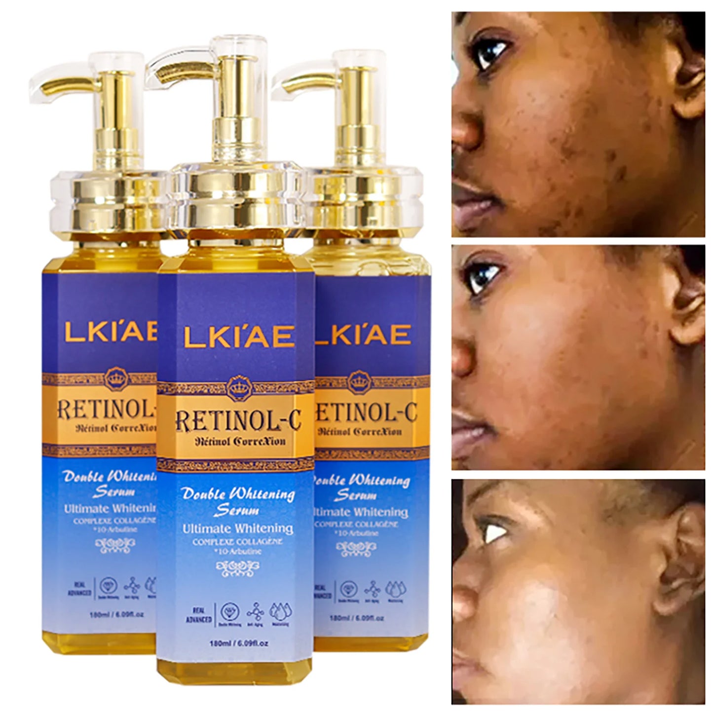 AILKE Advanced Retinol Whitening Skin Care Set For All Skin Types