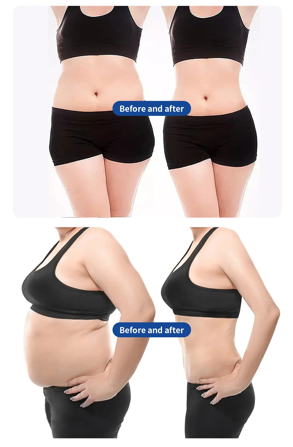 Myoslim Sculpt EMS RF Fat Burning Machine For Muscle Stimulation