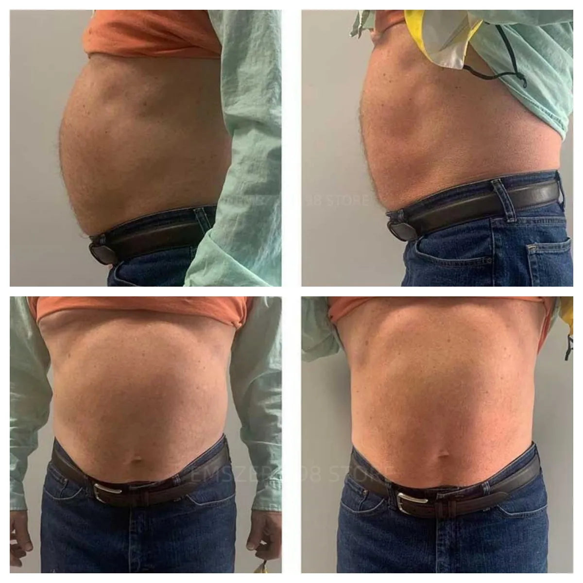 Myoslim EMS RF 6500W Body Slimming Sculpting Machine