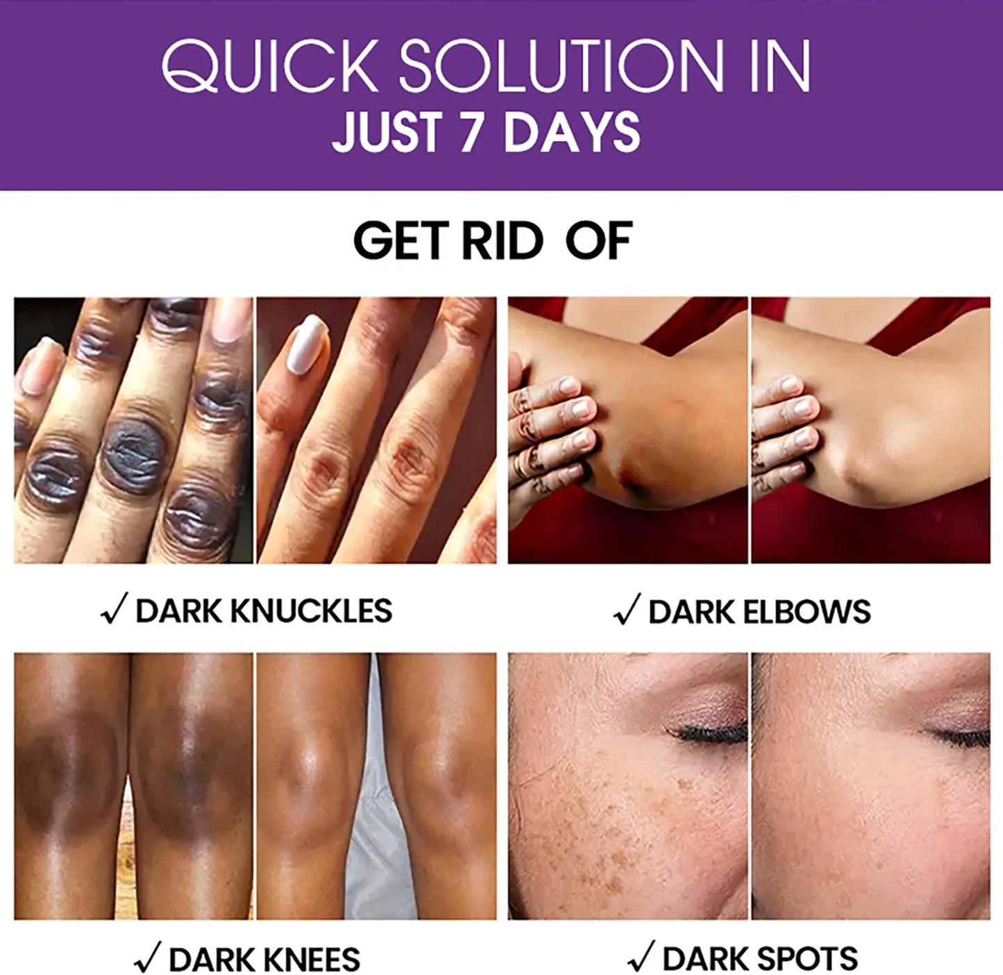 AILKE Anti Black Spots Intensive Serum Brightening for Radiant Complexion