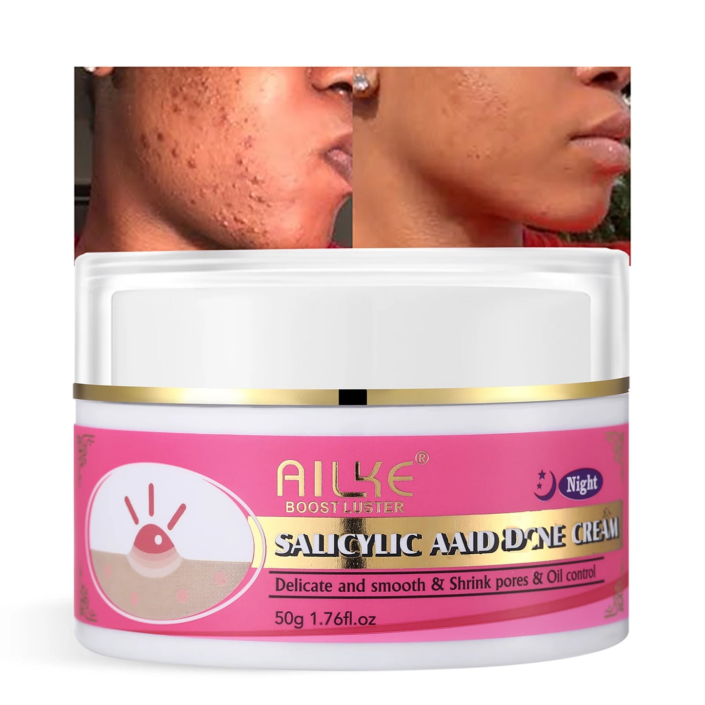 AILKE Organic Acne Face Cream Clear Skin And Oil Control