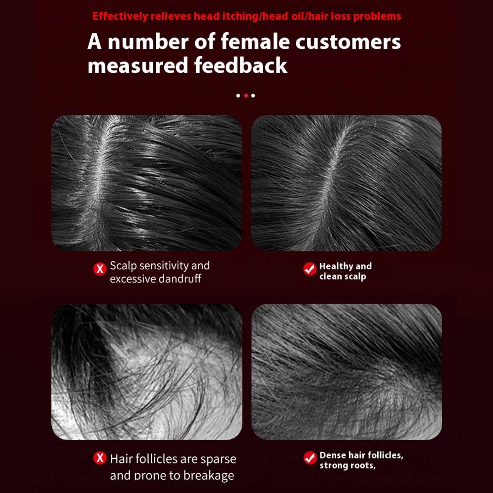 PASTSKY 3 Modes Electric Vibration Hair Growth Scalp Massager