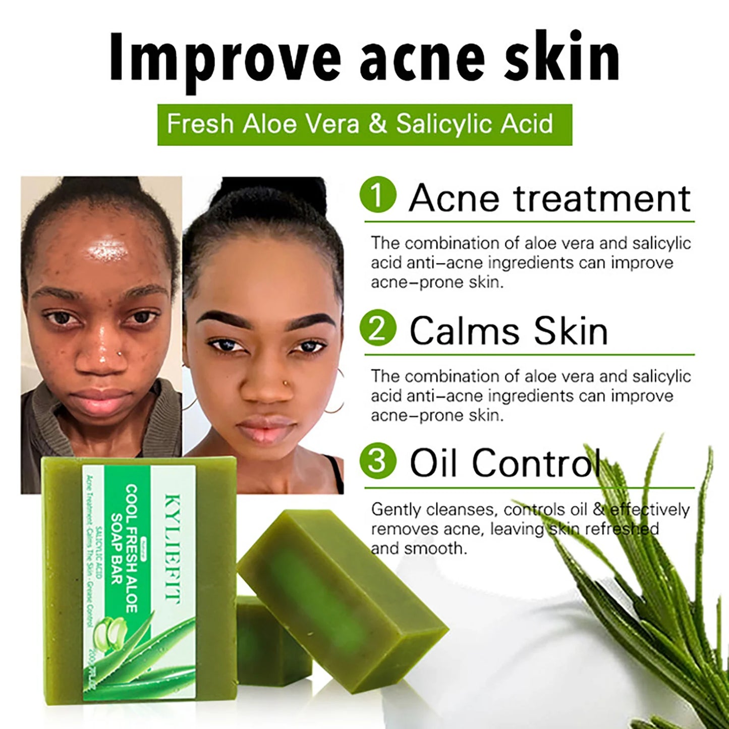 AILKE Aloe Vera Whitening Soap for Acne and Radiant Skin
